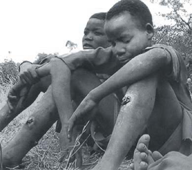 Ny&iacute;lt sebek a 12 &eacute;ves Majok l&aacute;b&aacute;n. Gazd&aacute;ja bambuszbottal v&eacute;resre verte.