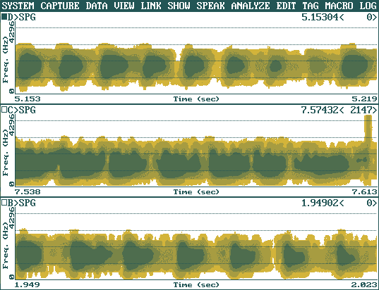 Az [l] hang tlagosan nyolc peridusrl kszlt spektrografikus kp klnbz szemlyek ejtsben